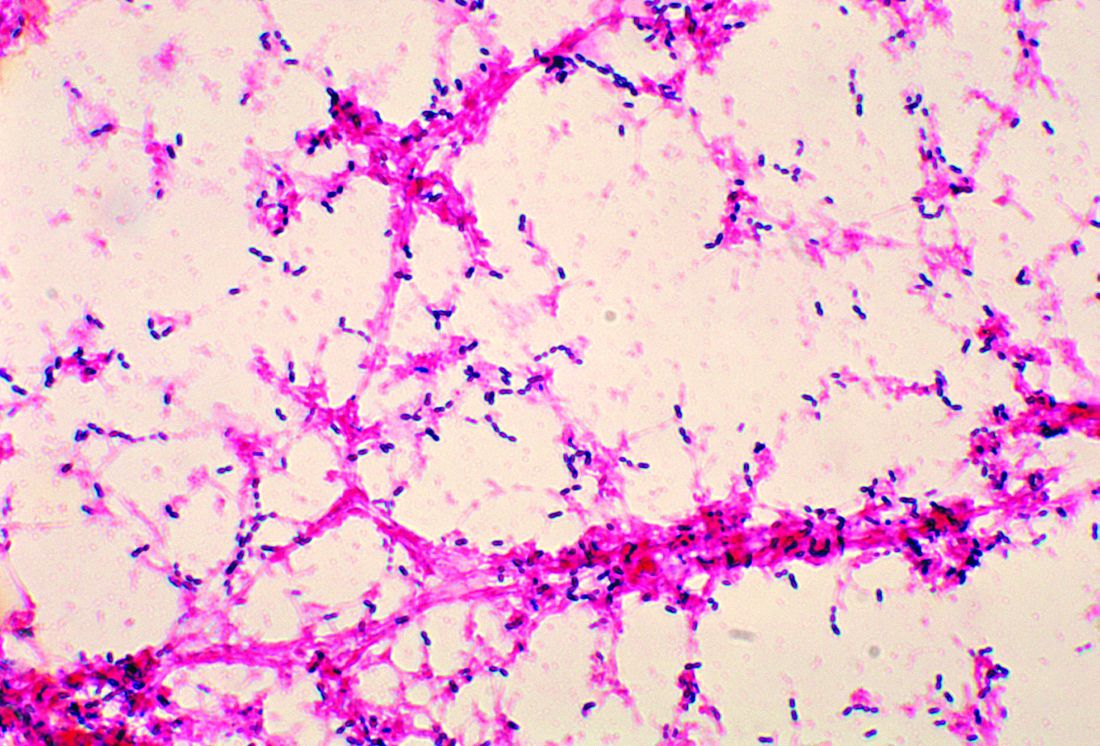 Streptococcal Pneumonias Resistance To Macrolides Increasing CHEST Physician