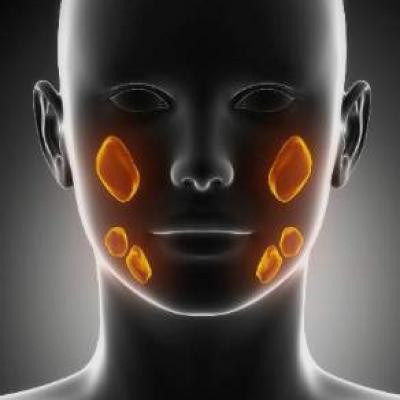 Radiation Field Optimization May Preserve Salivary Gland Function