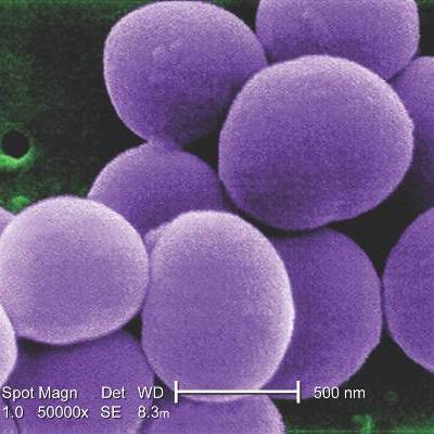 Staphylococcus Aureus Vaccine Tolerable Immunogenic In Preliminary