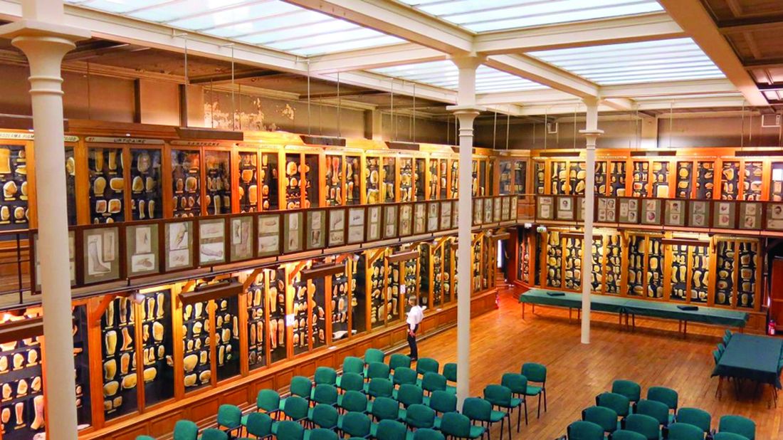 The Dr. Henri Feulard library, known as the Dermatology Wax Museum, houses the world’s largest collection of wax casts dedicated to teaching skin diseases and venereal diseases, with 4,807 pieces.