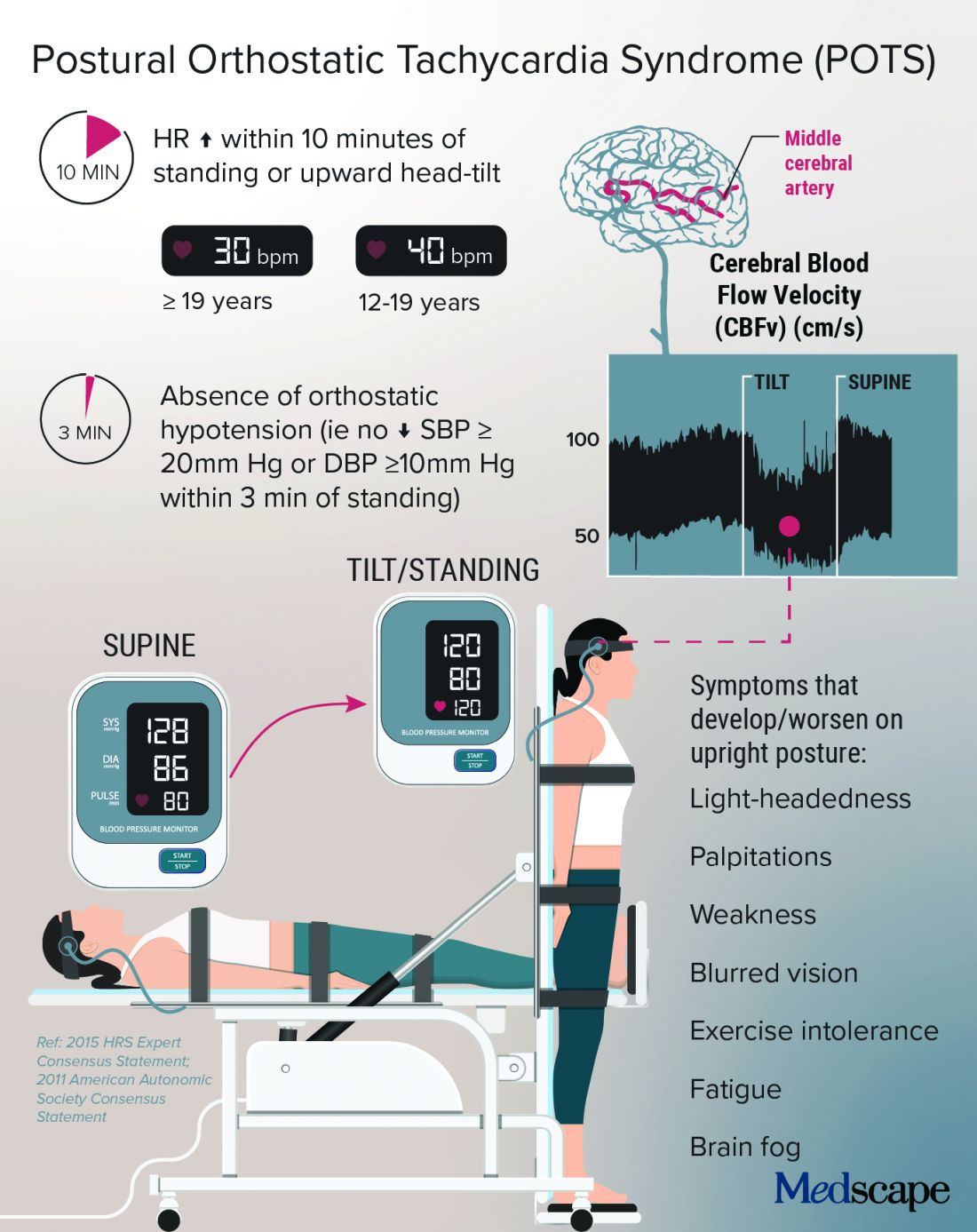 Illustration of postural orthostatic tachycardia tyndrome (POTS)