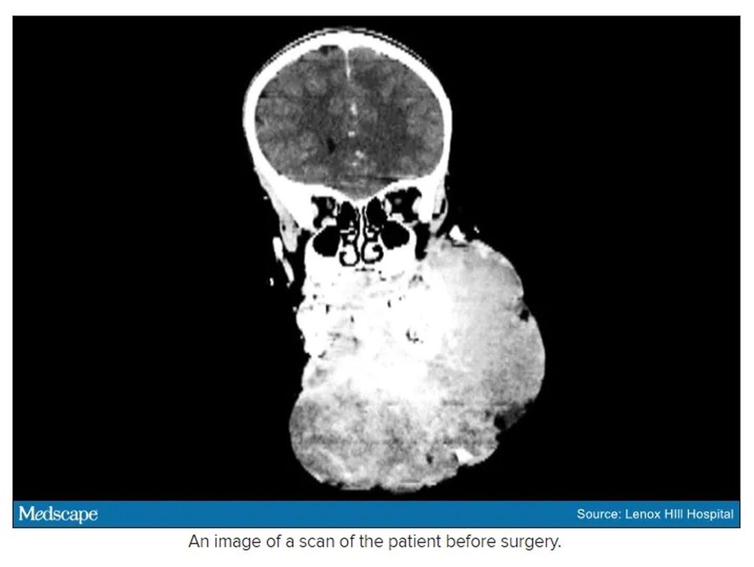 An image of a scan of the patient before surgery