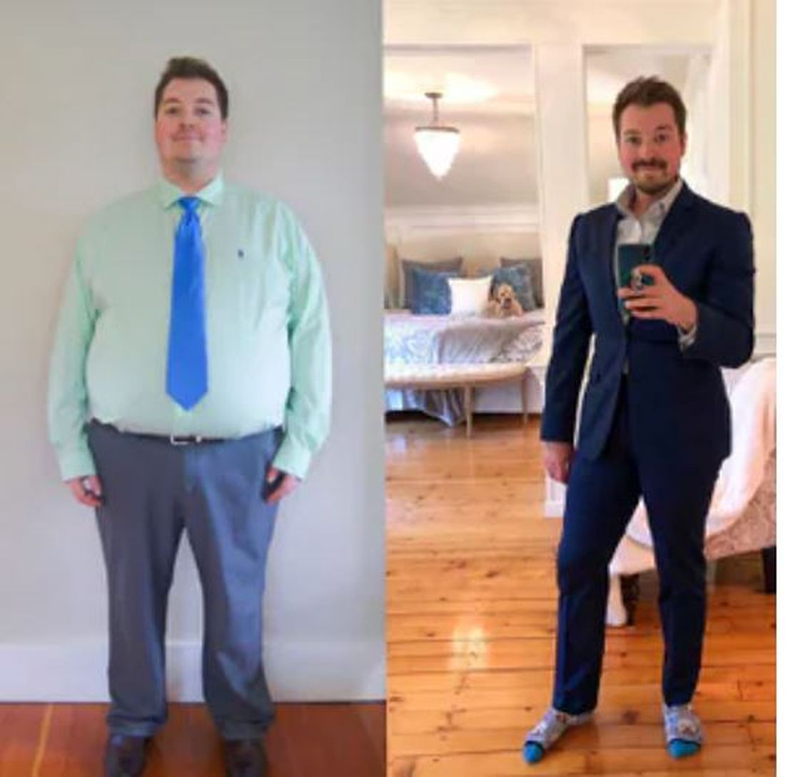 Dr. Kevin Gendreau, before and after losing 125 pounds in 18 months