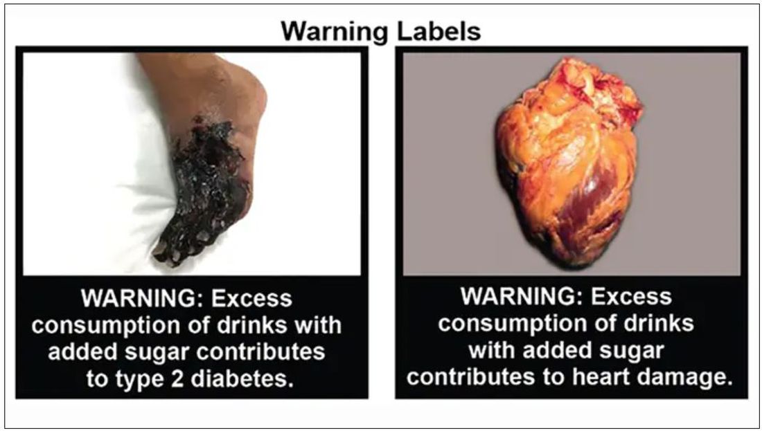 Warning labels on sugary drinks