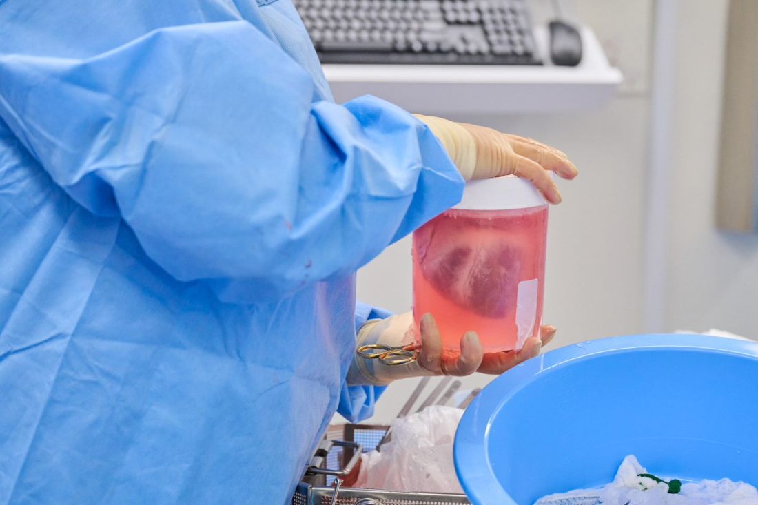 A genetically modified pig heart suspended in solution ahead of xenotransplantation at NYU Langone Health on July 6, 2022, in New York City.
