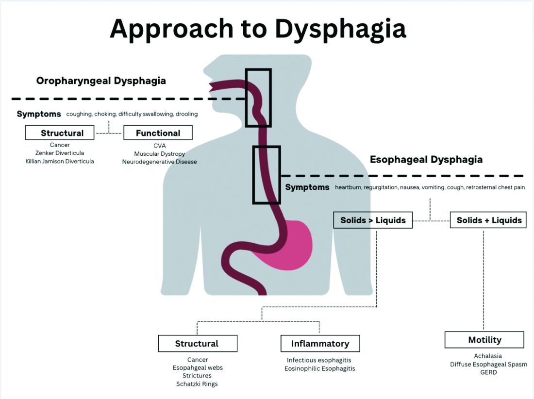 Approach to dysphagia