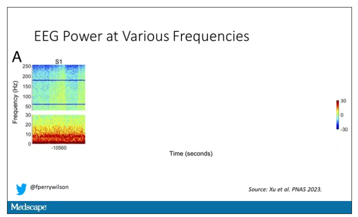 graphic of EEG power at various frequencies