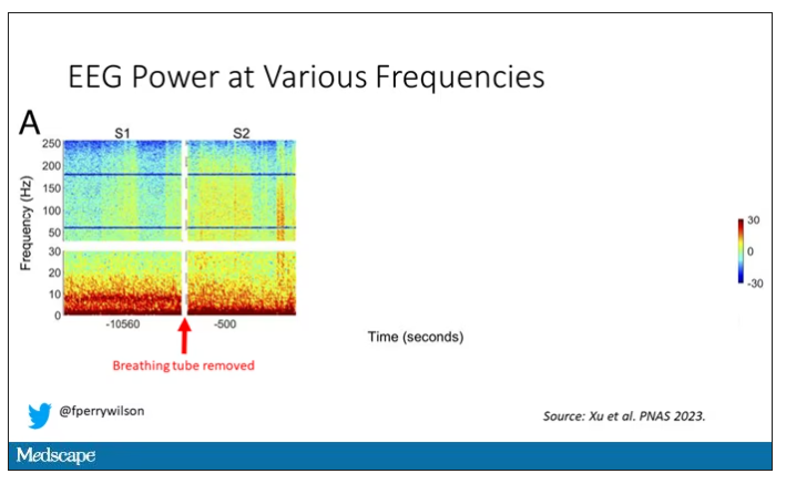 EEG power at various frequencies