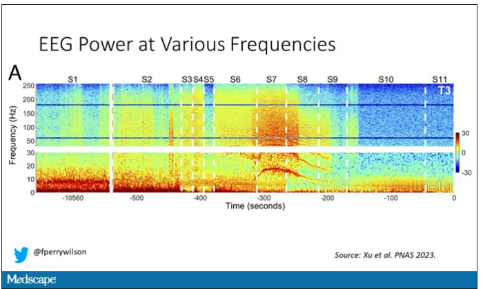 EEG power at various frequencies