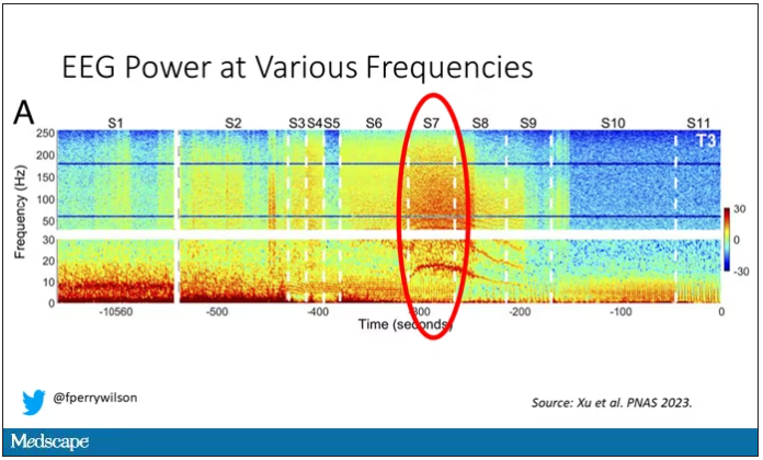 eeg power at various frequencies