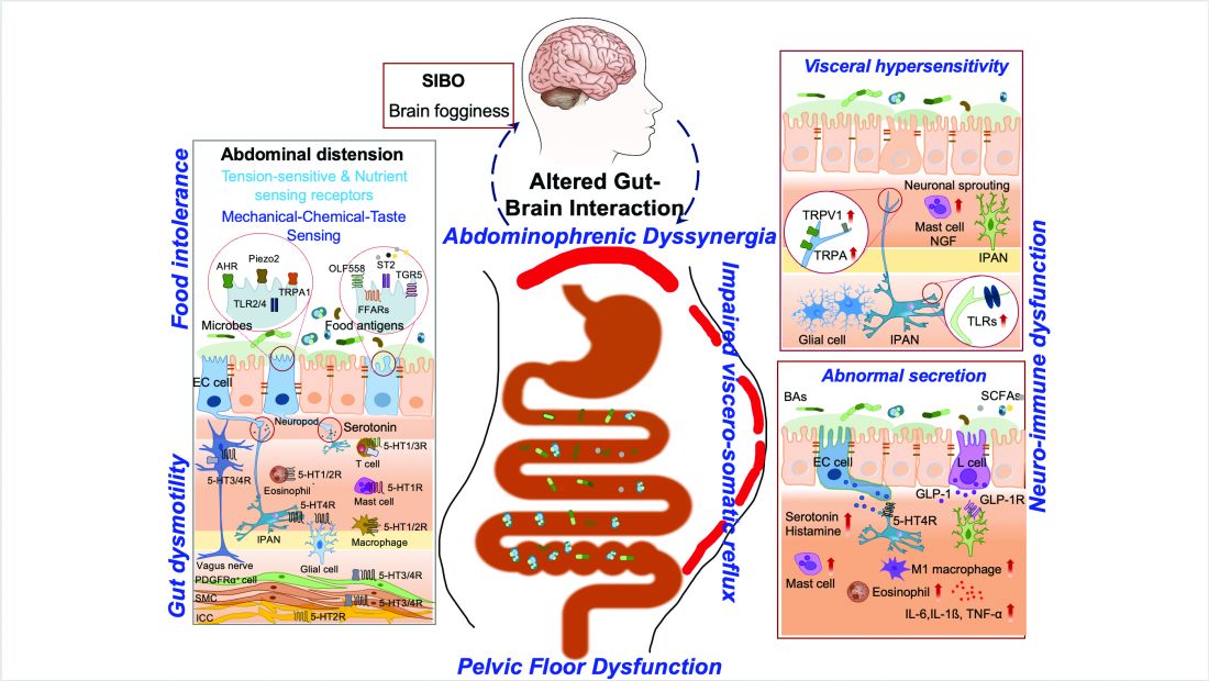 Figure 1. Proposed pathophysiological mechanisms underlying abdominal bloating/distension.