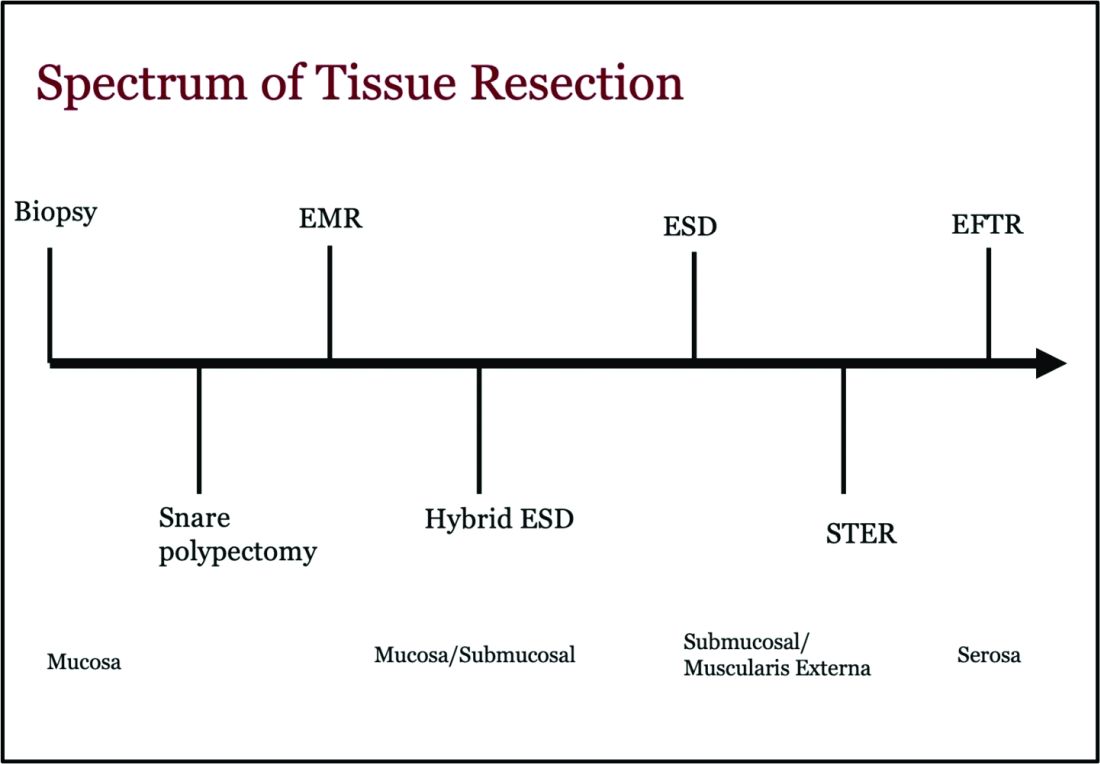 Figure 1: Spectrum of Tissue Resection