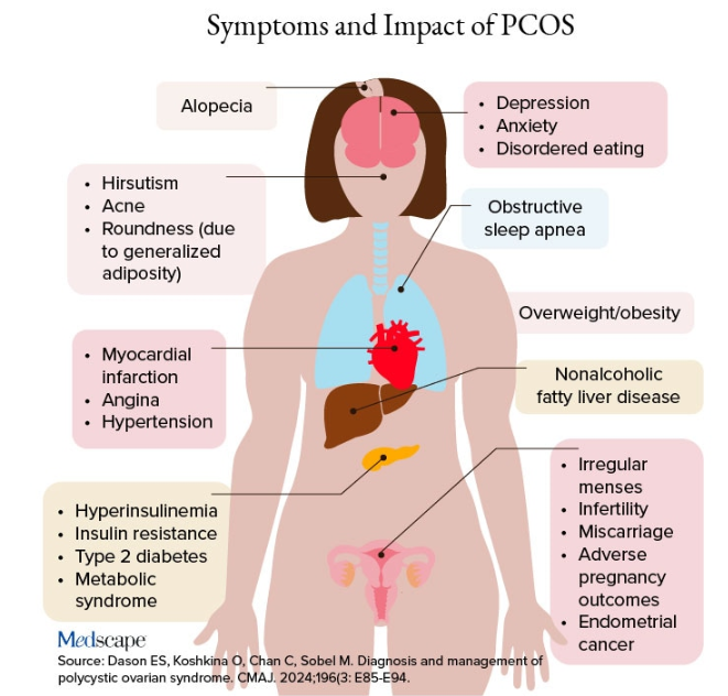 Symptoms and Impact of PCOS