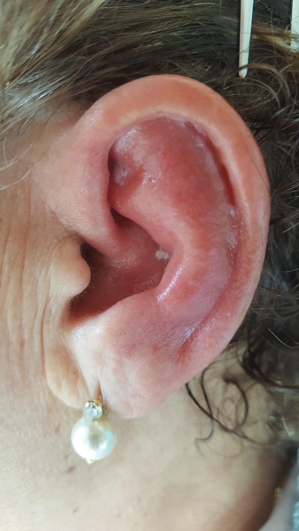 behind ear swollen and sore