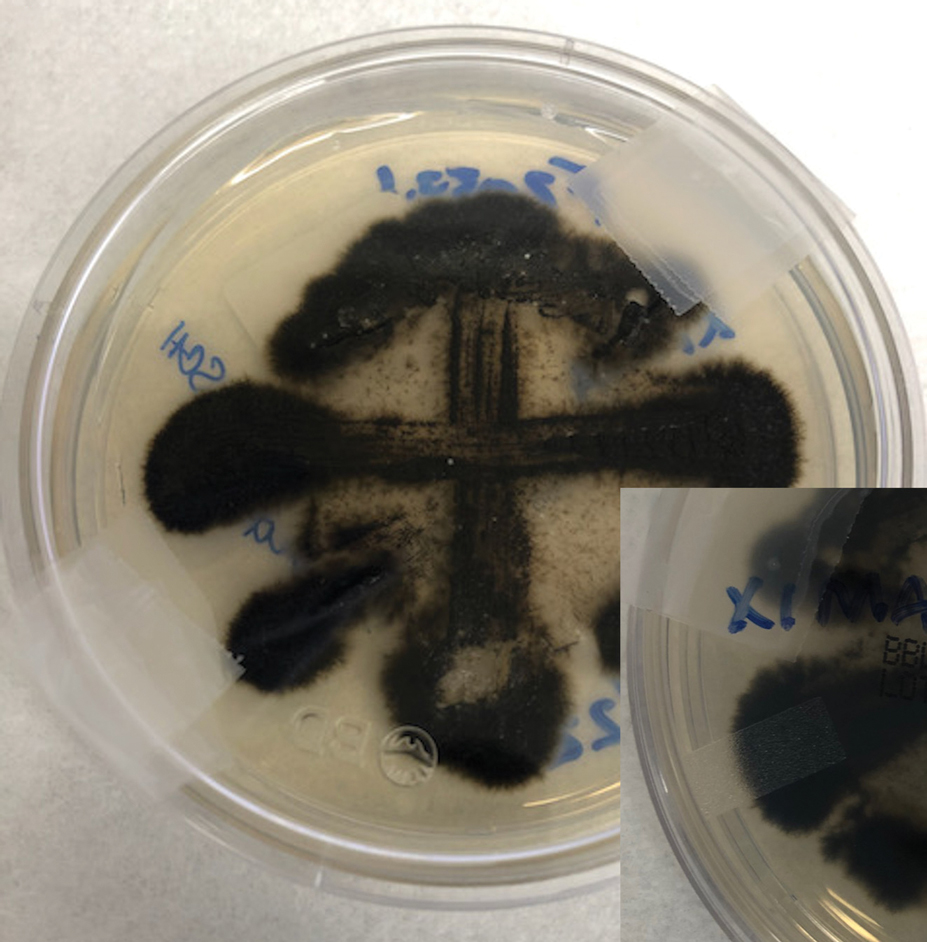 Anterior view of darkly pigmented, filamentous fungi grown on a Sabouraud dextrose agar culture plate at 25 °C.