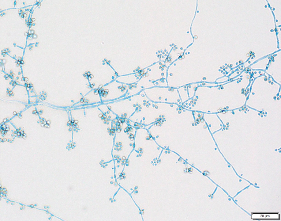 Lactophenol blue stain of the mold form demonstrated septate hyphae with conidiophores arising at right angles and clustered microconidia resembling rose petals (original magnification ×60). 