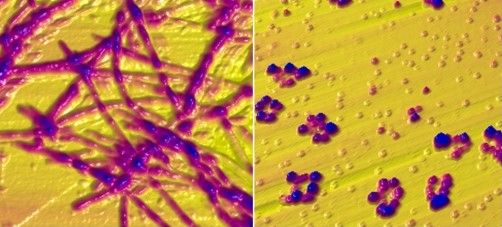 Alpha-synuclein in the form of fibrils (left). When the protein is placed in a solution containing copper, ring-like structures form instead (right).