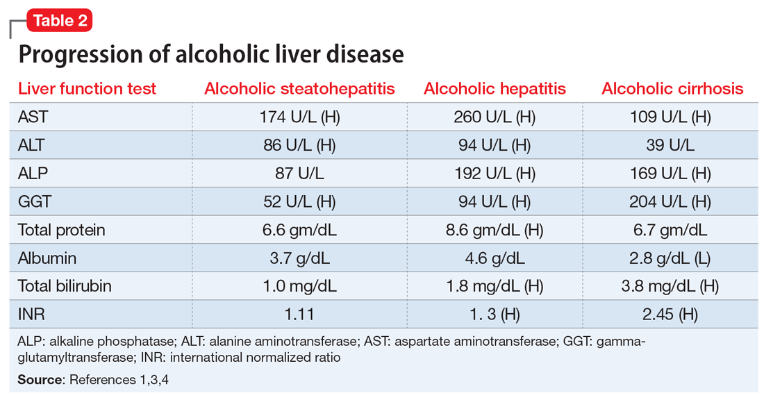 Progression of alcoholic liver disease