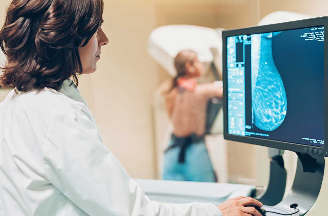 Breast cancer screening