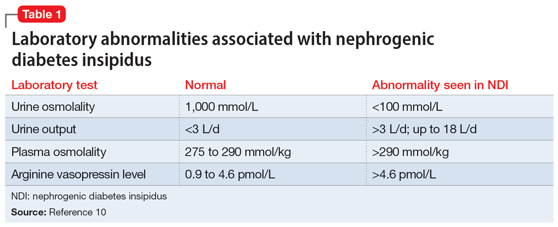 Laboratory abnormalities associated with nephrogenic diabetes insipidus
