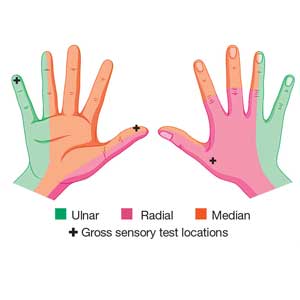 Nerve Sensation Distributions