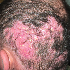 head with rash