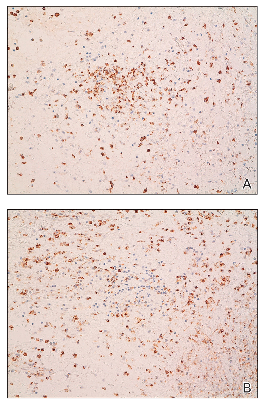 Immunohistochemical findings