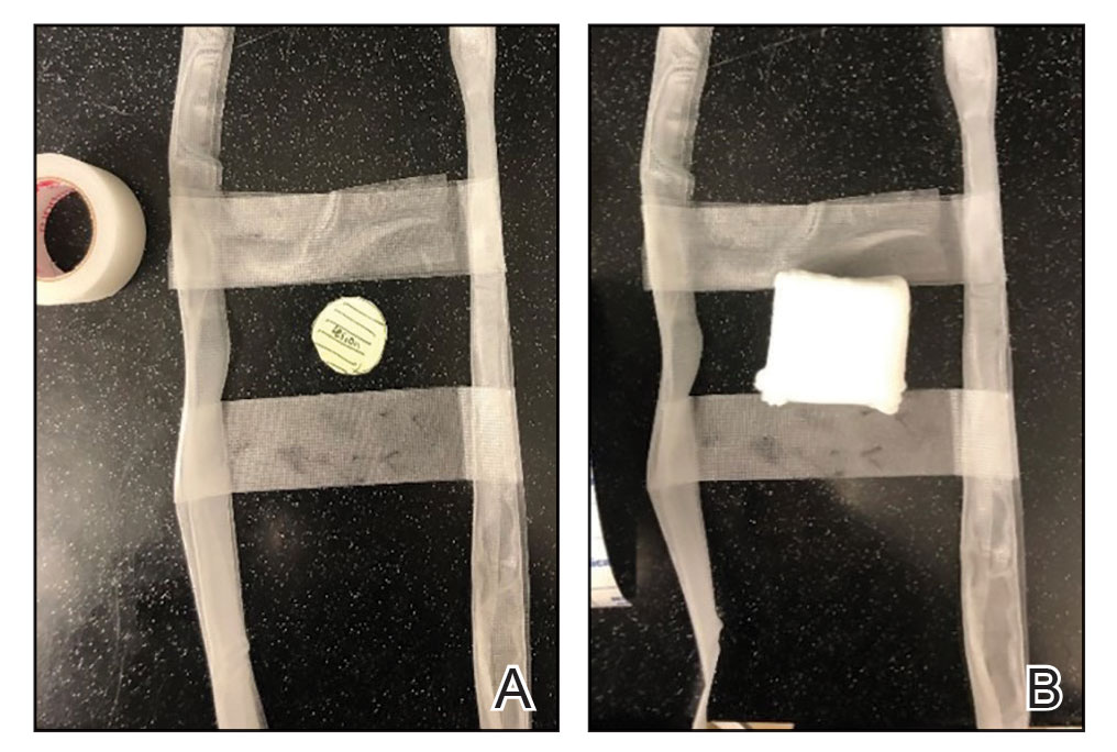 A, Step 1 in preparing prototype #1 bandage: create 2 pull tabs, each 2-feet long, using bandaging tape folded on itself once horizontally. Place these tabs on either side of the lesion, then secure to the patient with adhesive gauze.