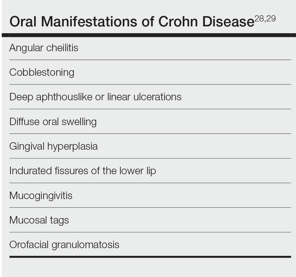 Oral Manifestations of Crohn Disease