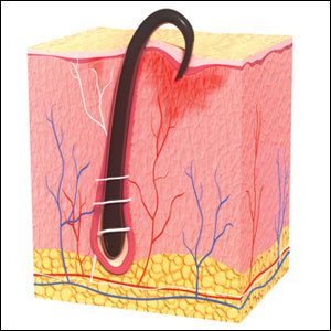 Pseudofolliculitis barbae has been associated with shaving