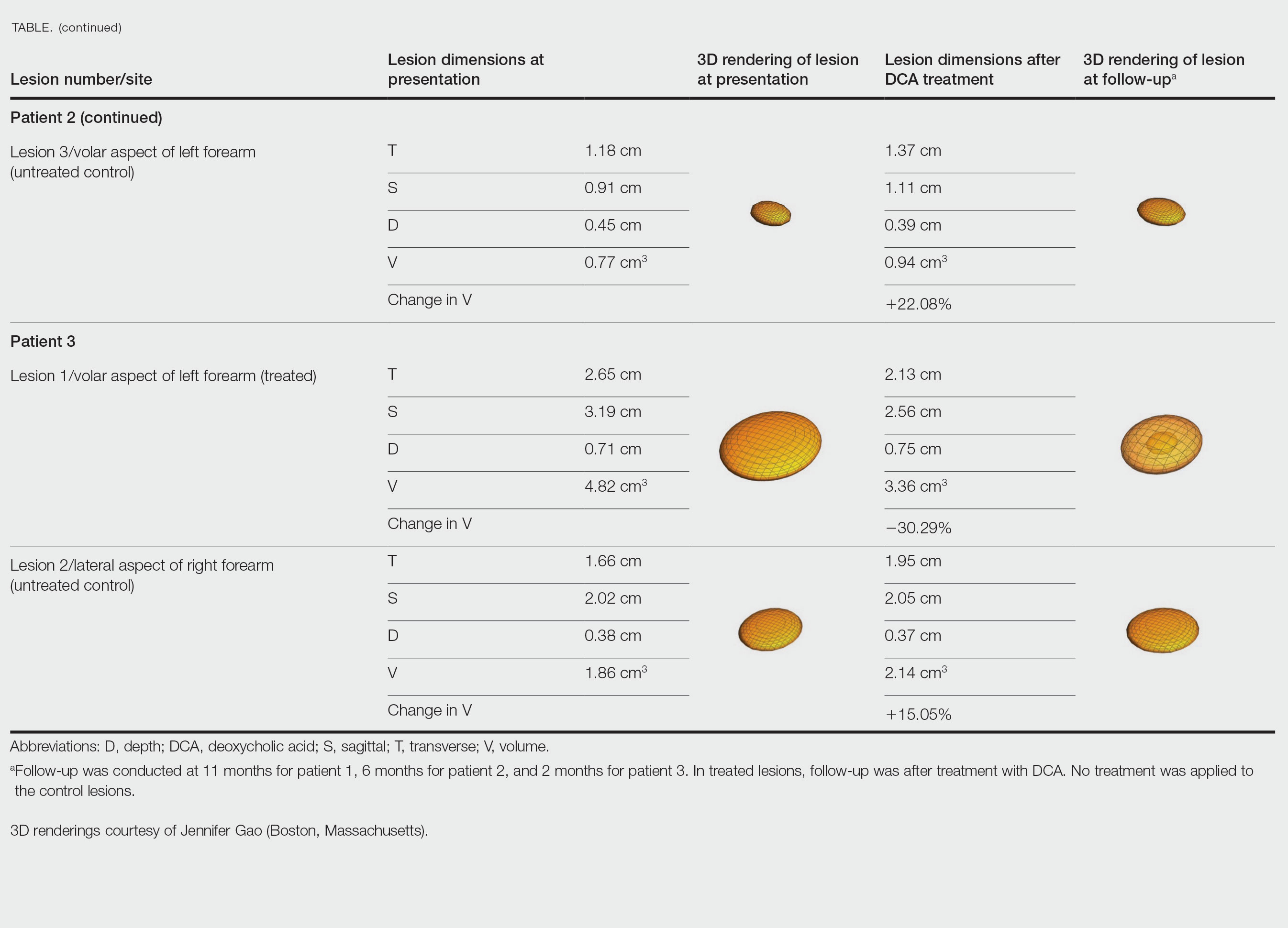 Lipoma Dimensions and Volumes of 3 Patients With Dercum Disease