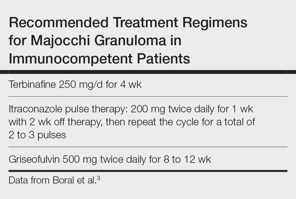 Recommended Treatment Regimens for Majocchi Granuloma in Immunocompetent Patients