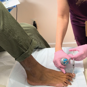 A portable massager is applied on the thigh to provide distraction in a patient who is receiving an anesthetic injection prior to dermatologic surgery on a toenail.