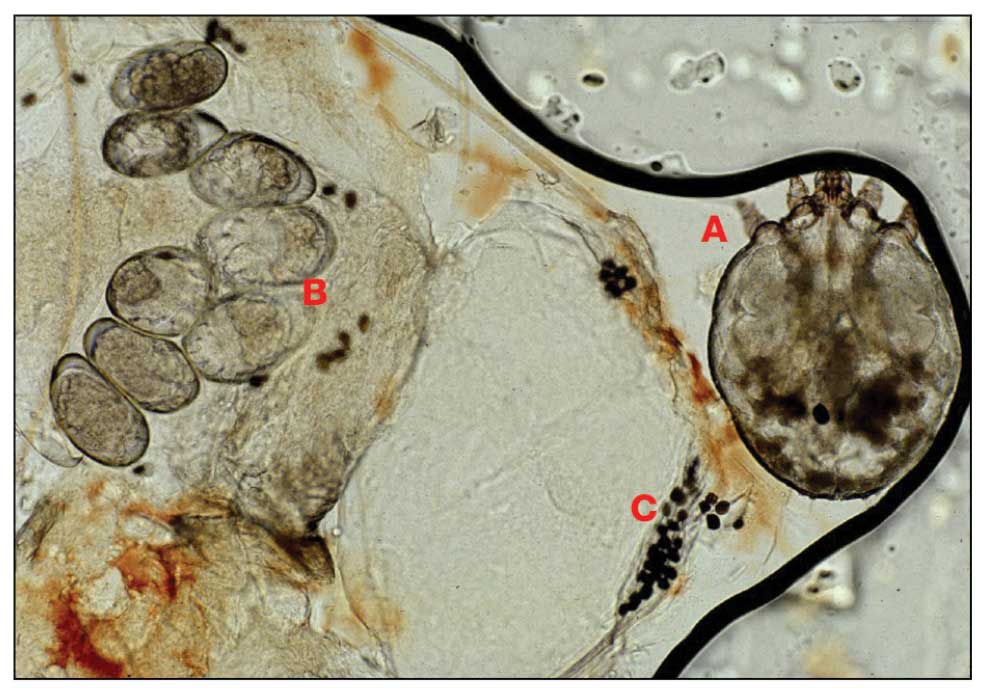 Sarcoptes scabiei mite (A), ova (B), and scybala (C) on microscopic evaluation.