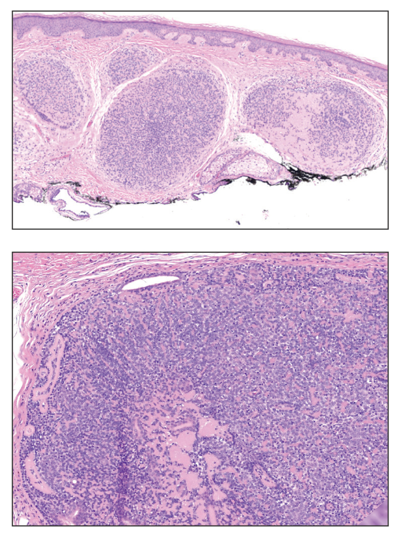 H&E, original magnifications ×40 and ×100, respectively.