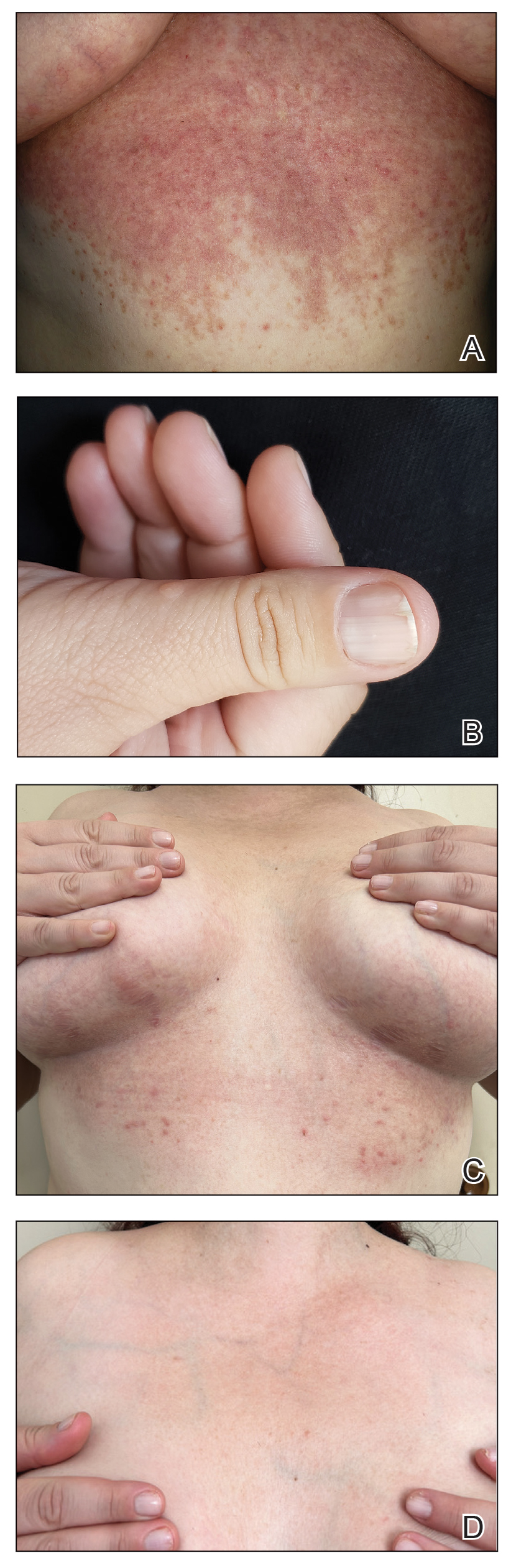 Cutis | MDedge