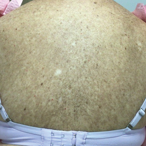 CT116001005_e-300x300.jpg