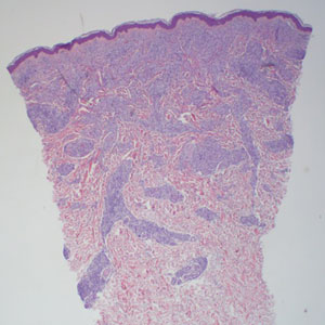 CT116004110_e_300x300