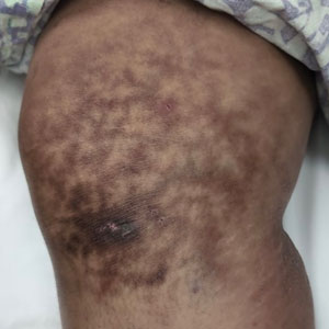 CT116005009_e_300x300