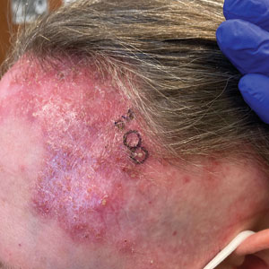 CT116005014_e_300x300