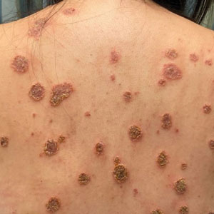 CT117001014_e_300x300