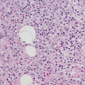 CT117001047_e_300x300