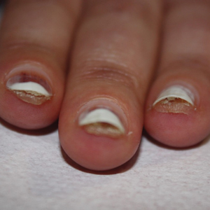 CT117002007_e_300x300