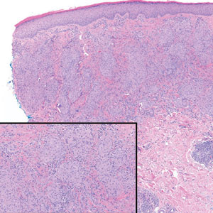 CT117006185_300x300