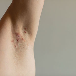 CT117006193_300x300.jpg