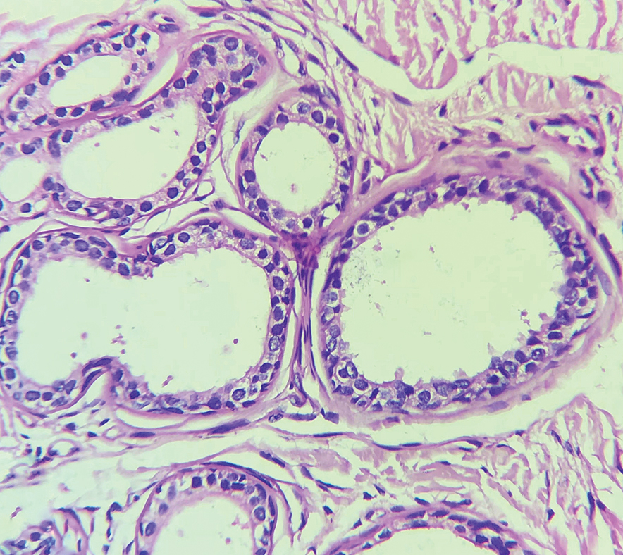 Histopathology visualized decapitation secretion from the inner layer of cells (H&E, original magnification ×40).