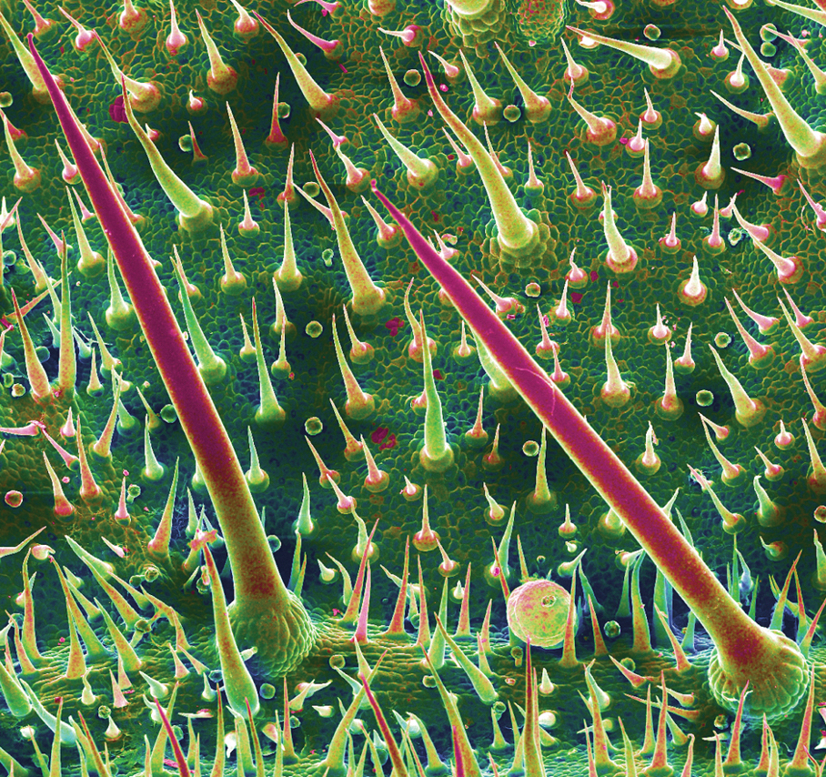 Stinging hairs resembling hypodermic syringes of Dendrocnide moroides. 