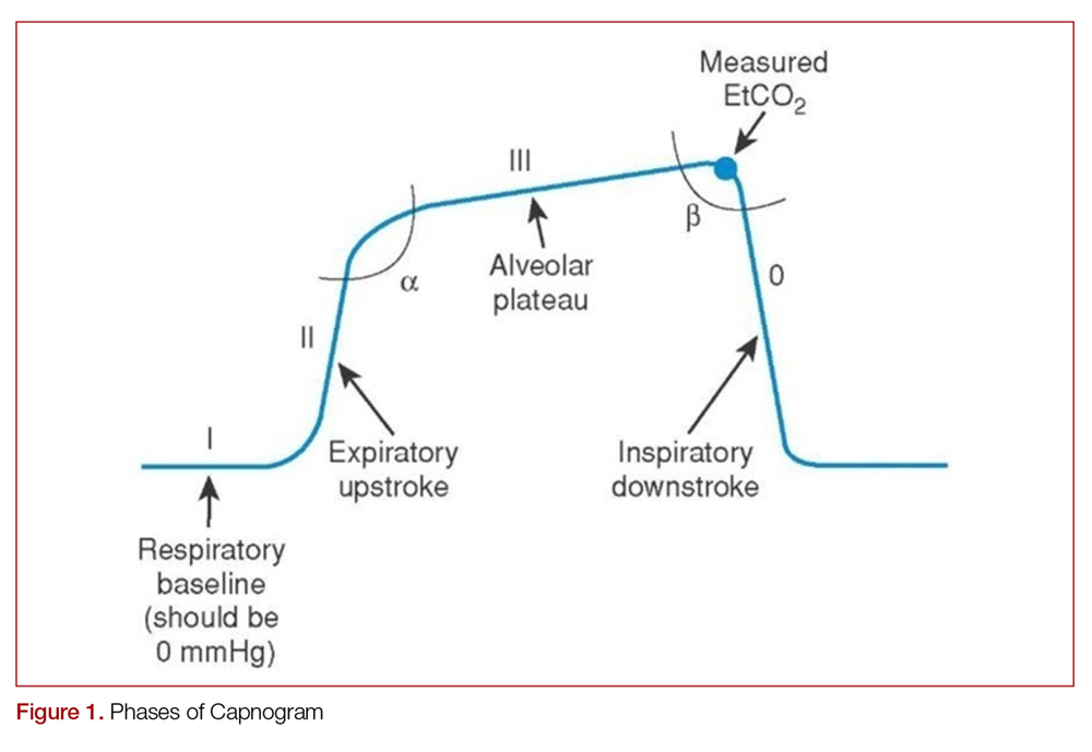 End Tidal Capnography in the Emergency Department MDedge Emergency