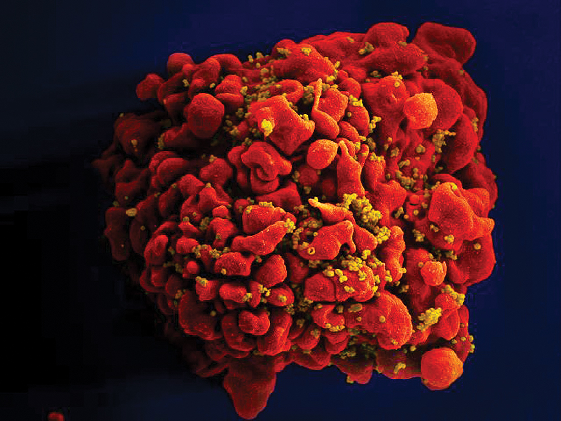 A T-cell infected by HIV particles is shown.