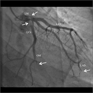24-year-old with history of smoking tobacco and cannabis • dyspnea • chest tightness
